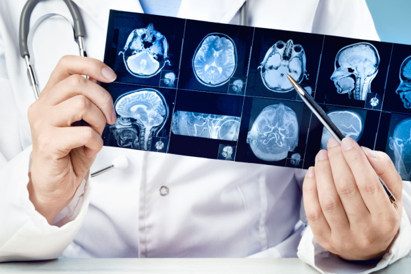 Feira de Santana liga alerta para vacinação após confirmação de caso de meningite bacteriana